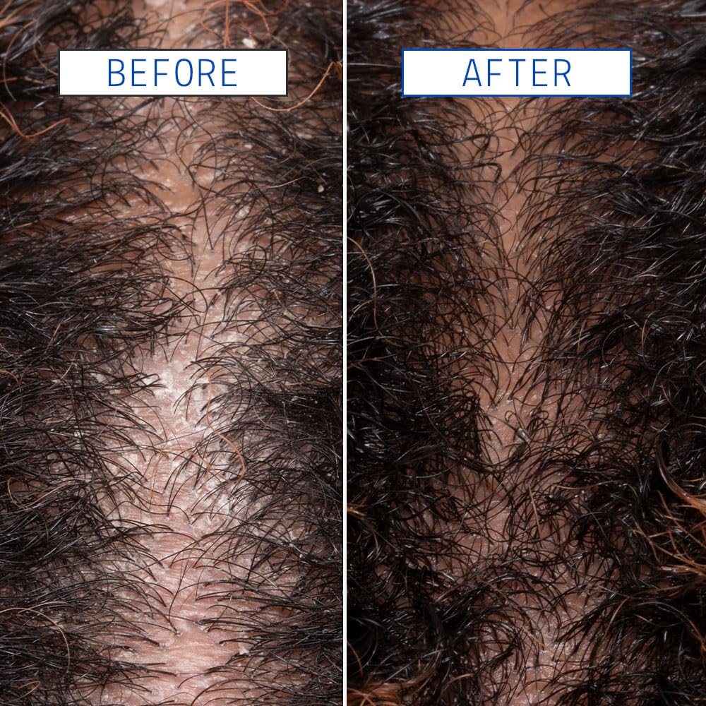 AAVRANI Scalp Detox Jelly Cleanser glycolic acid action on scalp for gentle cleansing.