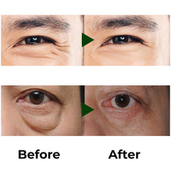 ABERA hydrates delicate under-eye skin with vitamin C and peptides.