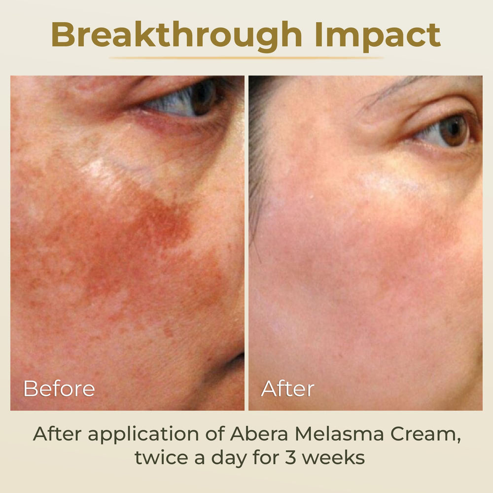 ABERA ingredient blend with licorice, arbutin, and niacinamide for brightening.