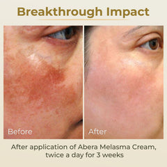 ABERA ingredient blend with licorice, arbutin, and niacinamide for brightening.