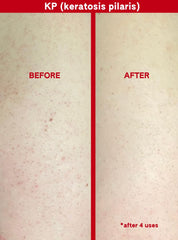 ABI AME ingredient close-up highlights glycolic and salicylic acids