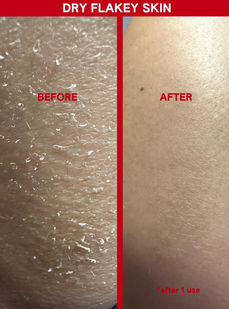ABI AME skin after use shows visibly smoother texture