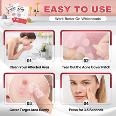 AcneGo tea tree oil patch supports gentle cleansing and soothing skin.