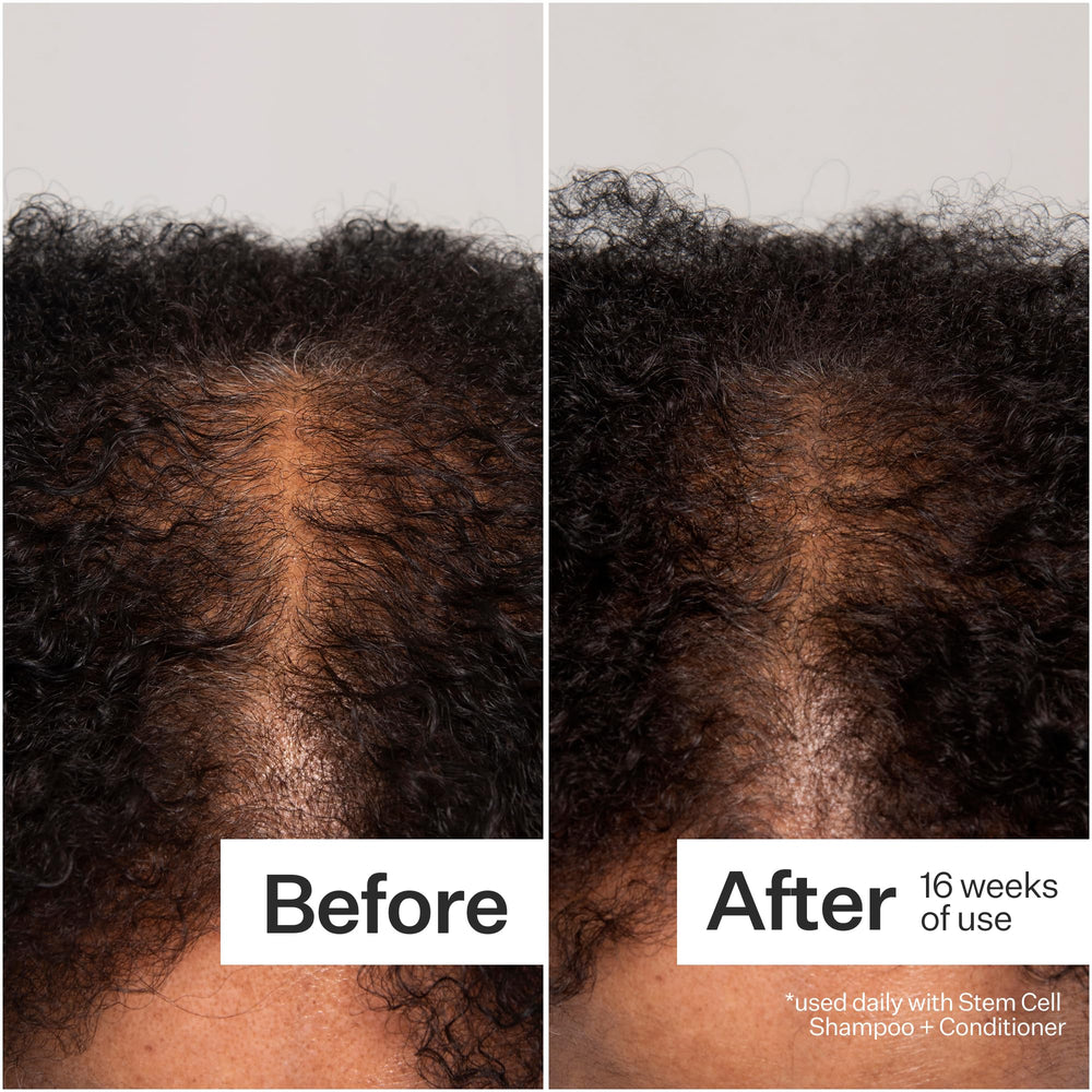Act+Acre clinical results graphic summarizes 12-week shedding reductions