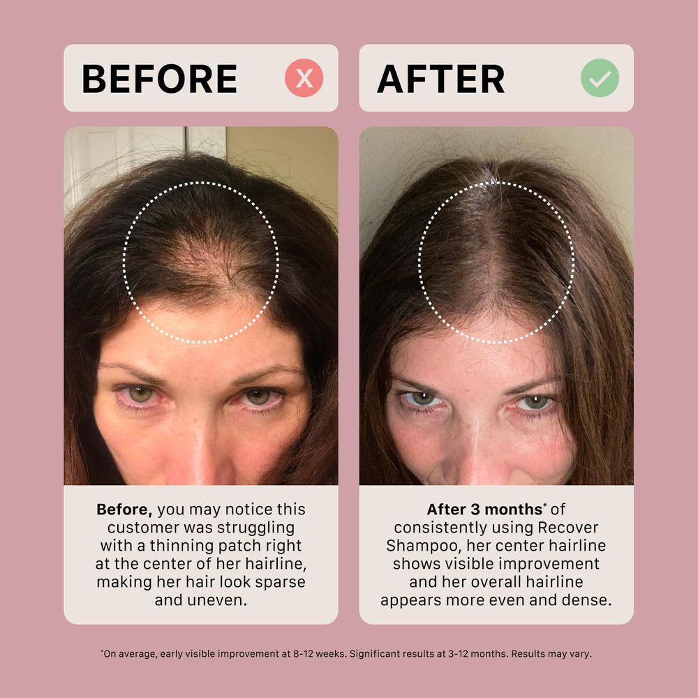 ACTIIV Recover shampoo packaging emphasizes vegan and color-safe benefits
