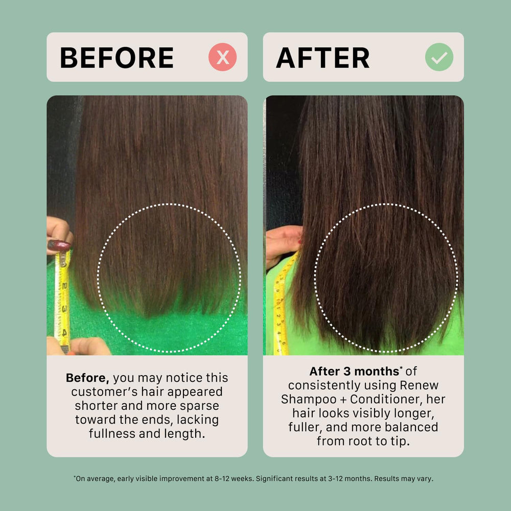 Plant-based formula image—ACTIIV Renew supports moisture with aloe extract.