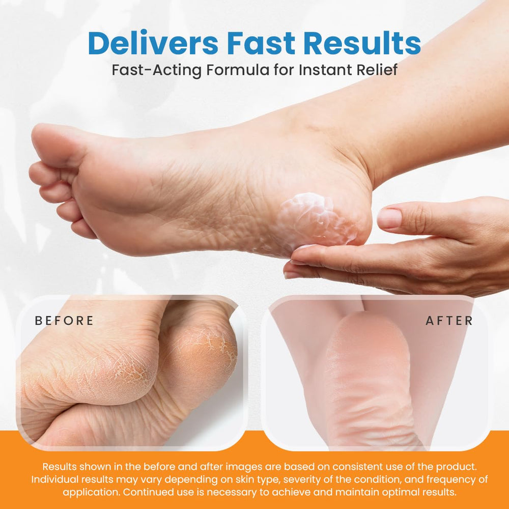 ActivLife RevitaDerm pumice stone included for at-home foot care smoothing.