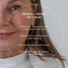 Advanced Clinicals eye cream application close-up demonstrates gentle hydration and subtle smoothing.
