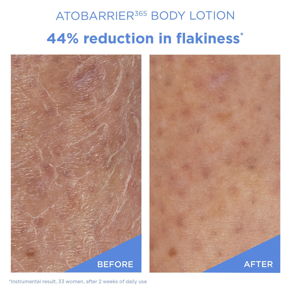 AESTURA ATOBARRIER365 ceramide capsules closeup shows barrier-supporting ingredients in action.