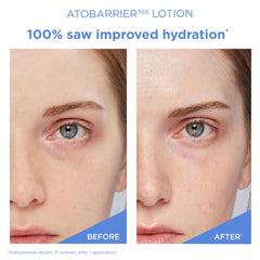 AESTURA ATOBARRIER365 triple lipid complex diagram outlines protective skin barrier support