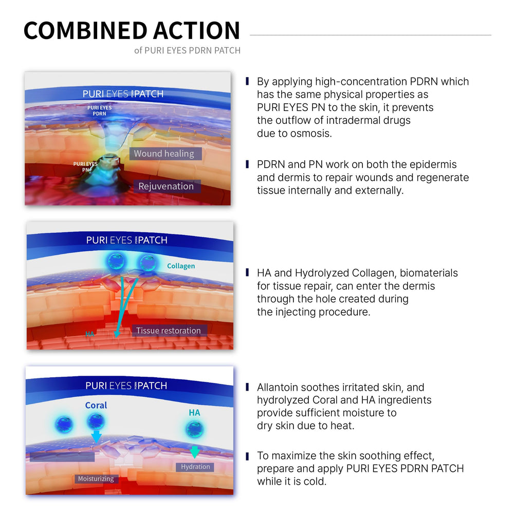 AETERDERM Puri Eyes PDRN Patch close-up emphasizes collagen-infused formula