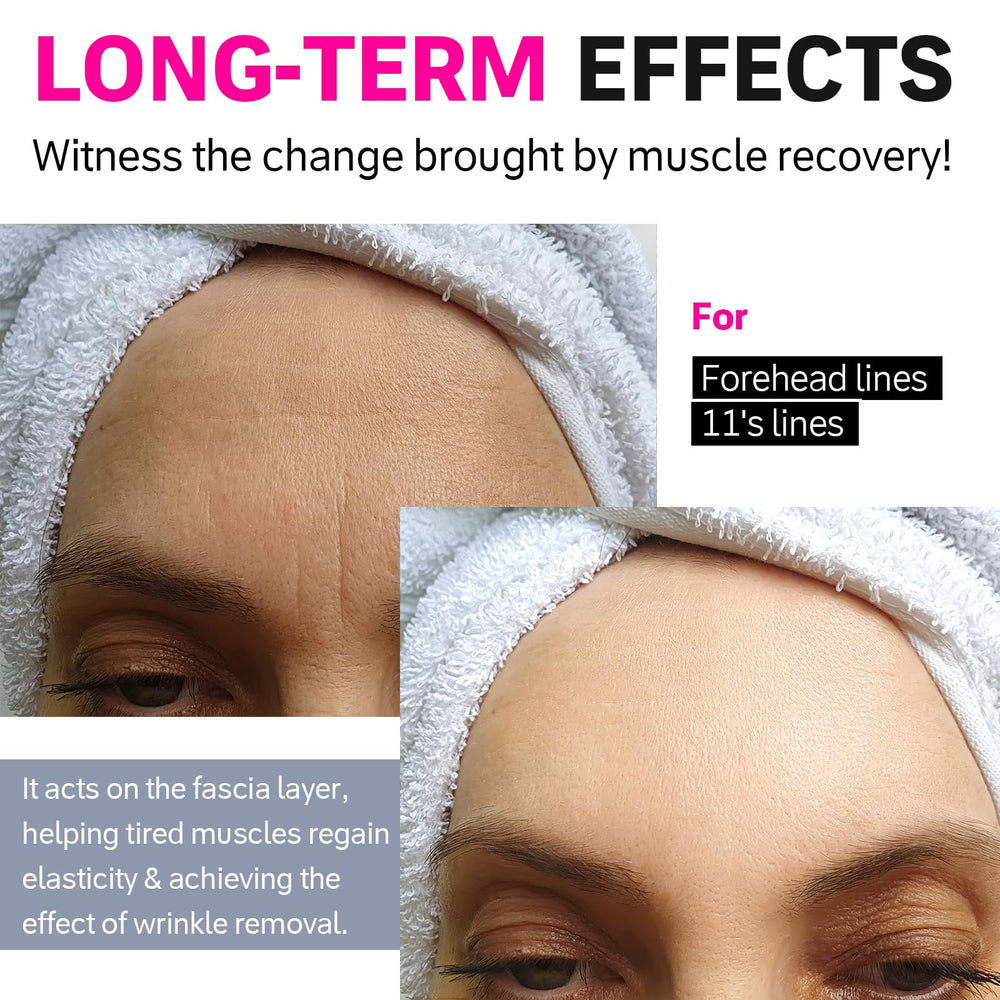 Overnight use scene with Akissos wrinkle patches on the forehead