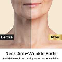 AKQBPN neck-wrinkle-patch curve-adhesion hugs the neck contour for a snug fit