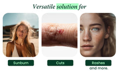Allurials Aloe Vera Spray on hair to calm scalp.