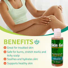 Aloe Life Skin Gel burn-relief formula supports gentle aftercare for damaged skin