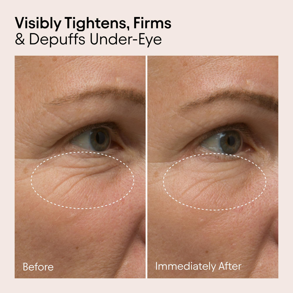 Bakuchiol and caffeine ingredients highlighted for brightening and puffiness reduction