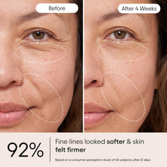 Alpyn Beauty cream swirl on skin highlighting hydrating feel.