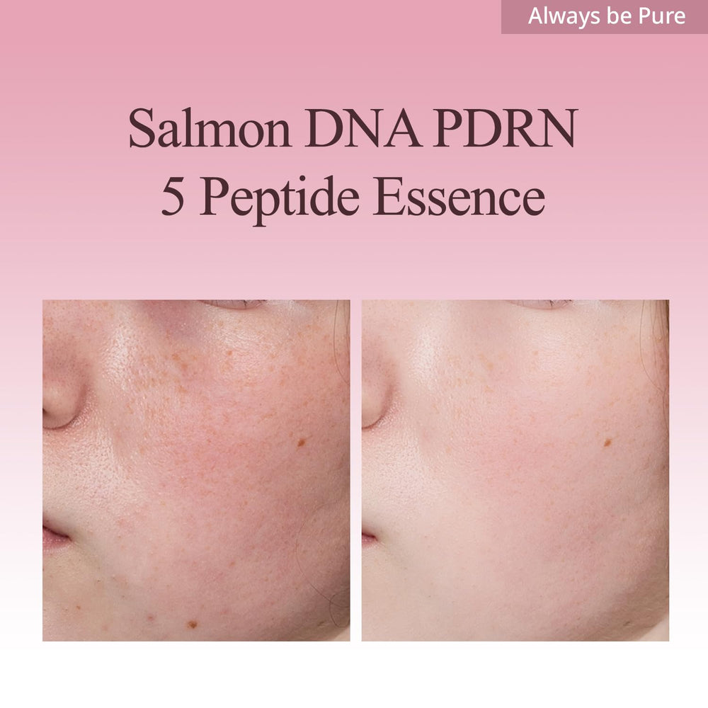 Always Be Pure Mela-PDRN essence applied on hand showing smooth texture