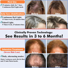 AmaBiuty hair growth cap in use during relaxed home sessions.