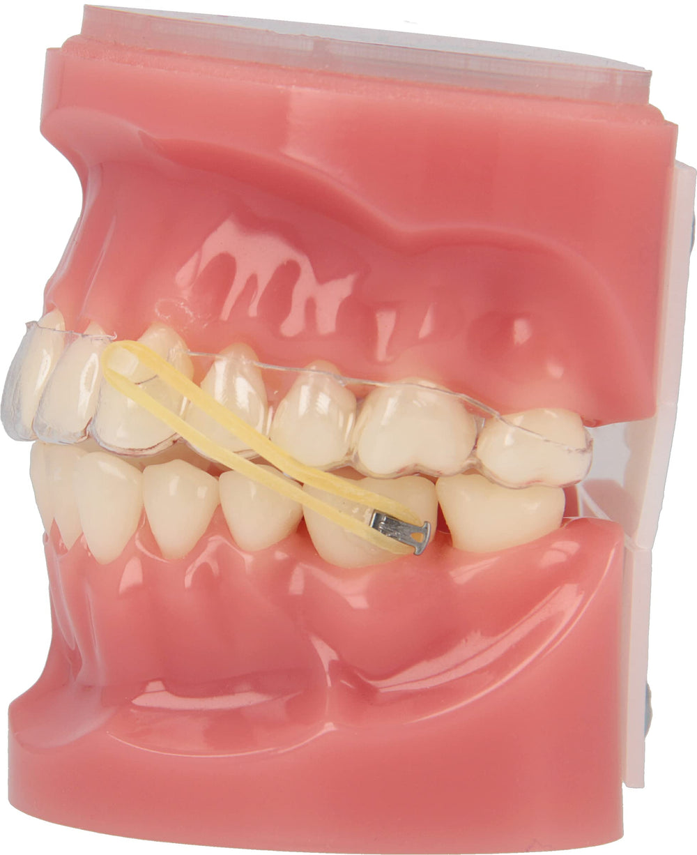 Neon panda elastics by American Orthodontics simplify color-coded selection in practice