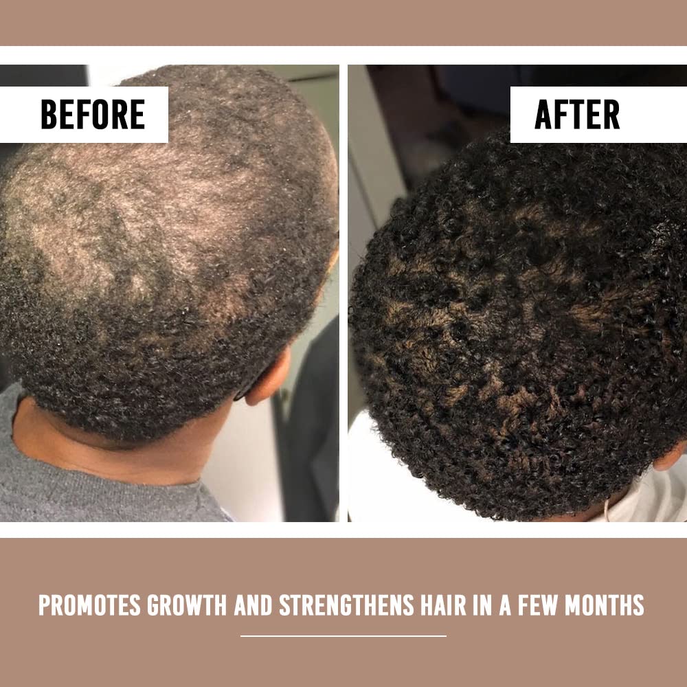 Spa-like setup with Amyla serum near towel