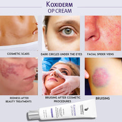 Anacis Vitamin K1 Oxiderm Cream focuses on under-eye area for a refreshed look.
