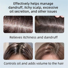 Anti-dandruff shampoo lather demonstrates gentle cleansing and refreshing feel.