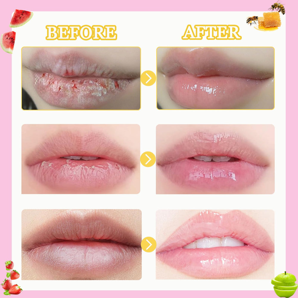 Anweina Bee Lip Balm Cherry Pot with cherry scent and gentle moisture.