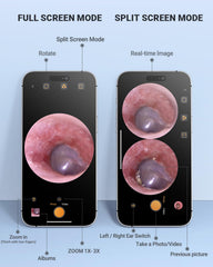 AnyScope HD split-screen mode lets you compare live and previous images.