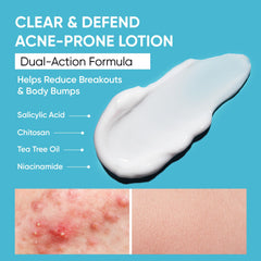 Aobbiy body acne lotion texture improving skin as applied.