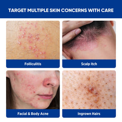 AOSORW facial application illustrates gentle, multi-area skincare.
