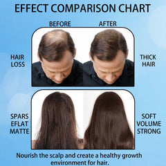 Aparthy salicylic acid exfoliates scalp gently for improved texture.