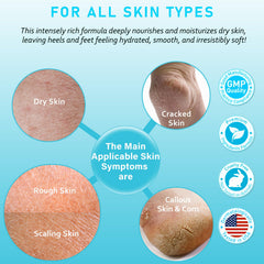 Aphesia Urea 40% enriched with shea, camellia, and jojoba oils for nourishment.