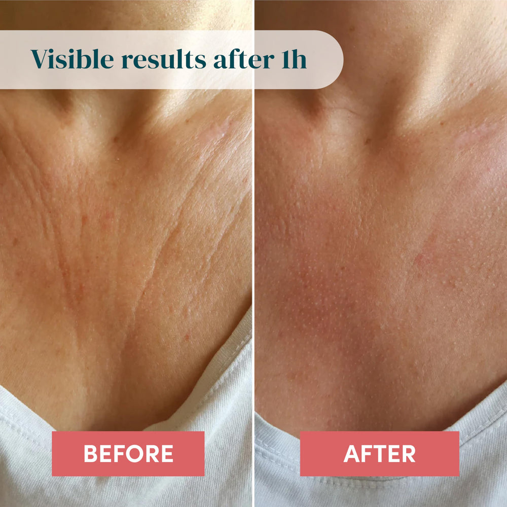 APRICOT Beauty Decollete Pad Overnight delivers all-night wear for softer skin.