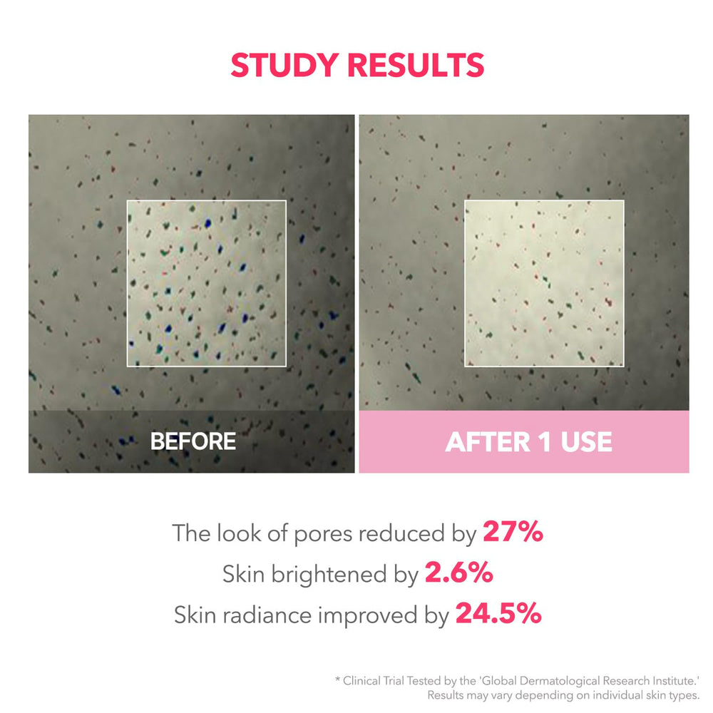 APRILSKIN TXA Niacinamide 99 mask peel reveal for smoother skin