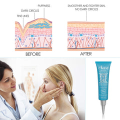Aqua Mineral Under-eye application scene showing quick-absorb gel.