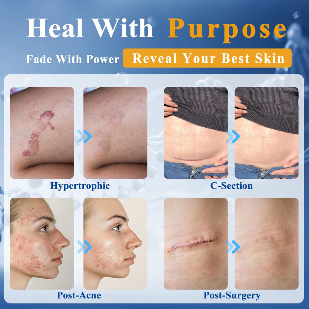 Arme Scar Gel application demonstrating fast absorption without greasy residue.