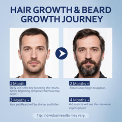 Artimore 5% Minoxidil serum angled bottle shot for easy bedside application.