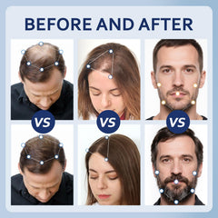 Artimore Minoxidil twice-daily routine setup for consistent application.