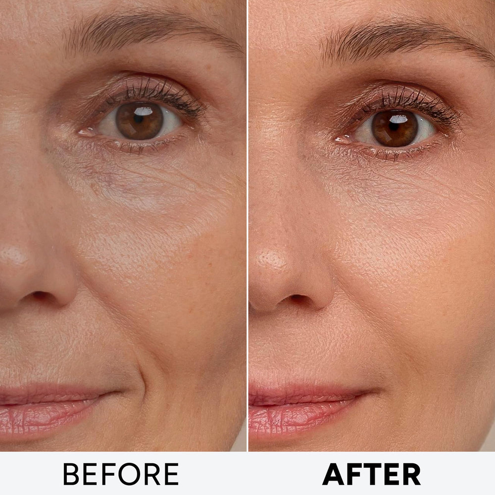 Arvesa Retinol Cream for daily skin use, gentle enough for sensitive skin.