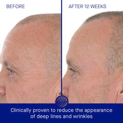 Serum being applied, illustrating quick hydration and renewal with Augustinus Bader.