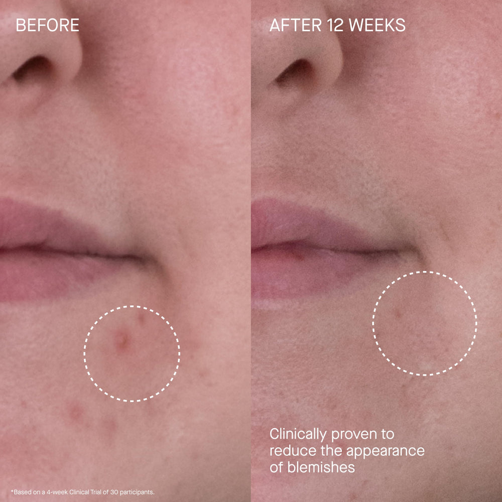Massage of The Rich Cream on neck and décolleté to support elasticity