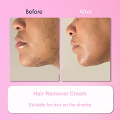 Aurlux Hair Remover Cream delivers skin-smooth results after use.