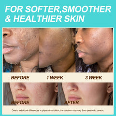 Auteli balm texture appears light and fast-absorbing on skin.