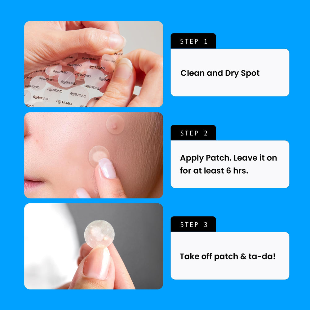 AVARELLE zit patches blend with skin tones for day and night wear.
