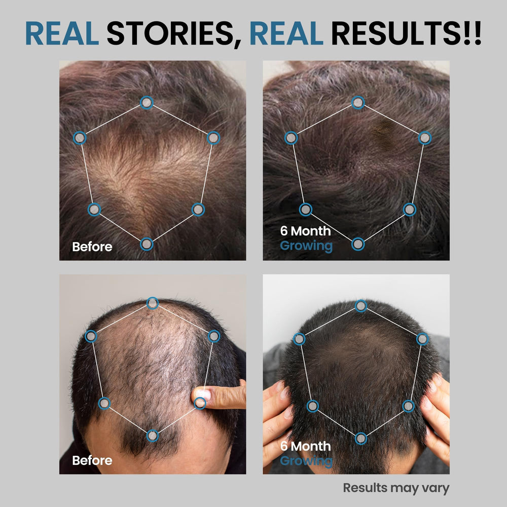 AVITAPURE ingredient panel with Biotin and Rosemary Oil