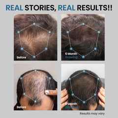 AVITAPURE ingredient panel with Biotin and Rosemary Oil