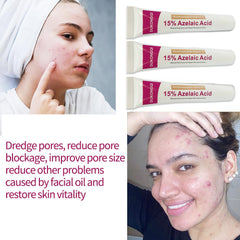 Azelaic Acid Serum texture close-up highlights smooth consistency.