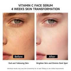BACHERI Vitamin C serum glow in daily routine indicates brightening potential.