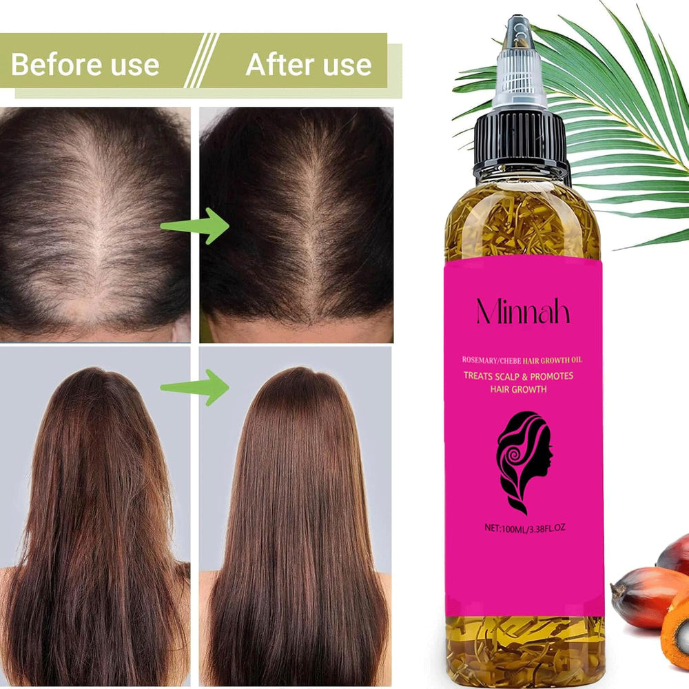 BALPPRD Minnah Batana Oil nightly care for healthier-looking hair.